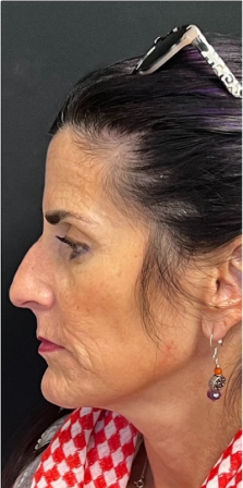 NeoGen #7 After Image