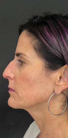 NeoGen #8 After Image