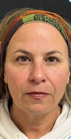 NeoGen #6 After Image