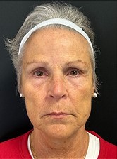 NeoGen #10 Before Image