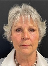 NeoGen #10 After Image